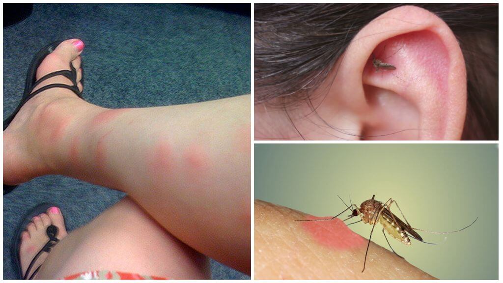последствия укуса комара